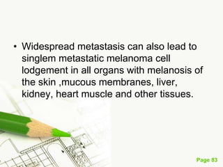 Melanoma (malignant melanoma)