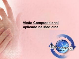 Melanoma Classificação ABCD | PPT