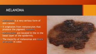 Melanoma.pptx