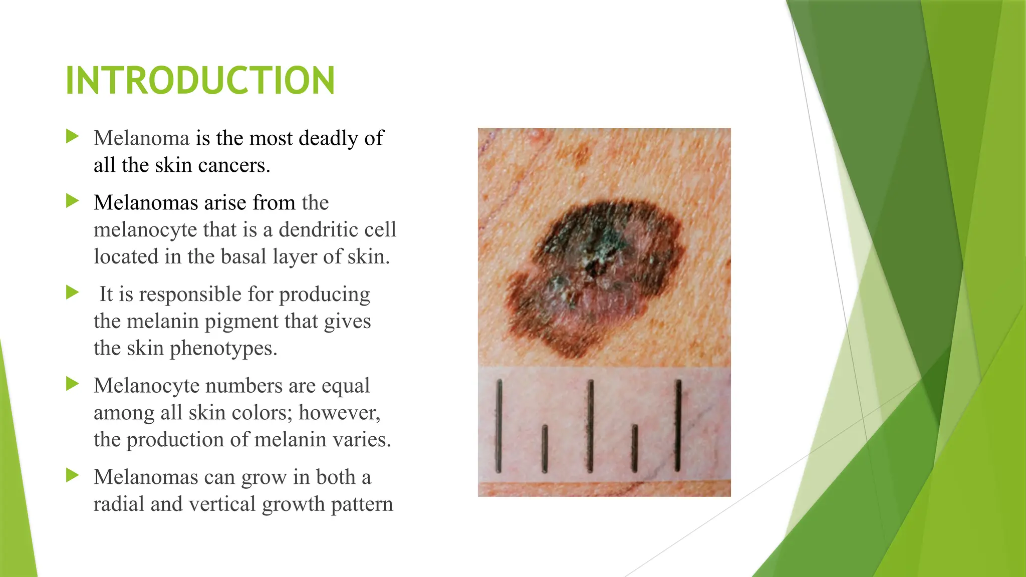 A Skin Cancer Overview, Understanding Melanoma Cancer , Causes ...