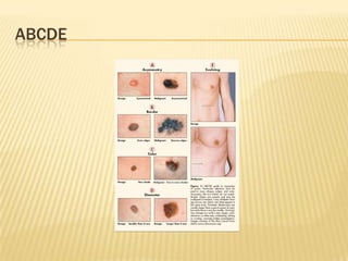 ABCDE
 