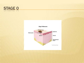 STAGE 0
 