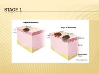 STAGE 1
 