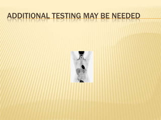 ADDITIONAL TESTING MAY BE NEEDED
 