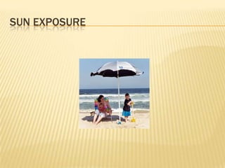 SUN EXPOSURE
 