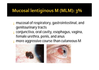 ¡   mucosal of respiratory, gastrointestinal, and
    genitourinary tracts
¡   conjunctiva, oral cavity, esophagus, vagina,
    female urethra, penis, and anus
¡   more aggressive course than cutaneous M
 