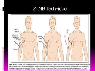Melanoma Made VERY Easy!! | PPTX