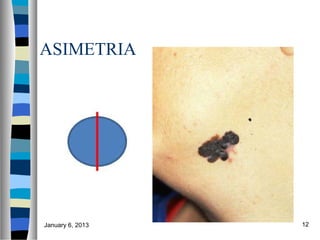 ASIMETRIA




January 6, 2013   12
 