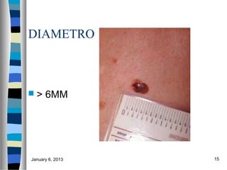 DIAMETRO



>    6MM




January 6, 2013   15
 