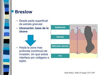  Breslow

  – Desde parte superficial
    de estrato granular
  – Ulceración: base de la
    úlcera




  – Hasta la zona mas
    profunda (continuo) de
    invasión, sin que exista
    interface por colágeno o
    tejido.



                               Mod Pathol. 2006;19 Suppl 2:S71-S87
 
