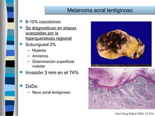 Melanoma acral lentiginoso
 8-10% caucásicos
 Se diagnostican en etapas
  avanzadas por la
  hiperqueratosis regional
 Subungueal 2%
    – Mujeres
    – Ancianos
    – Diseminación superficial,
      nodular
   Invasión 3 mm en el 74%

   DxDx:
    – Nevo acral lentiginoso




                                             Am J Surg Pathol 2008; 32:834
 