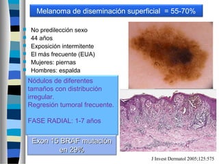 Melanoma de diseminación superficial = 55-70%

    No predilección sexo
    44 años
    Exposición intermitente
    El más frecuente (EUA)
    Mujeres: piernas
    Hombres: espalda
    Nódulos de diferentes
    tamaños con distribución
    irregular.
    Regresión tumoral frecuente.

    FASE RADIAL: 1-7 años


     Exon 15 BRAF mutación
            en 29%
                                       J Invest Dermatol 2005;125:575
 
