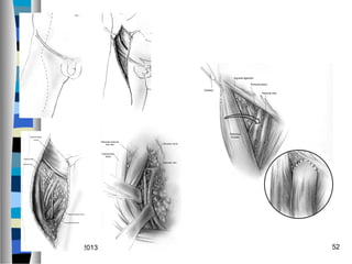 January 6, 2013   52
 