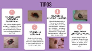 TIPOS
MELANOMA DE
EXTENSION
SUPERFICIAL
1
2
3
MELANOMA
NODULAR
MELANOMA
LENTIGO MALIGNO
Más común. Generalmente
es plano e irregular en forma
y color, con sombras
variables de negro y café. Es
más común en personas de
piel clara.
Generalmente empieza
como un área elevada de
color azul-negruzco oscuro
o rojo-azulado. Algunos no
tienen ningún color
Generalmente aparece en
las personas de edad
avanzada. Más común en la
piel dañada por el sol en la
cara, el cuello y los brazos.
Las áreas de piel anormal
generalmente son grandes,
planas y de color marrón con
áreas de color café.
4
MELANOMA
LENTIGOSO ACRAL
Forma menos común de
melanoma. Generalmente
ocurre en las palmas de las
manos, las plantas de los
pies o por debajo de las
uñas.
 