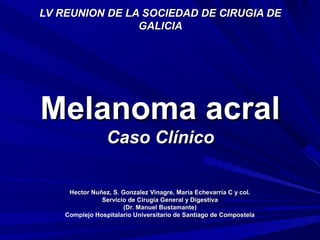 LV REUNION DE LA SOCIEDAD DE CIRUGIA DE
                GALICIA




Melanoma acral
                 Caso Clínico

     Hector Nuñez, S. Gonzalez Vinagre, María Echevarría C y col.
               Servicio de Cirugía General y Digestiva
                      (Dr. Manuel Bustamante)
    Complejo Hospitalario Universitario de Santiago de Compostela
 