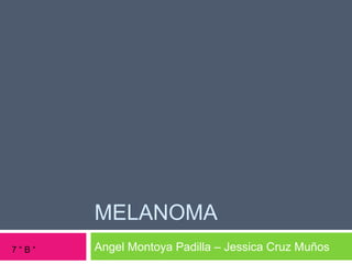 MELANOMA
Angel Montoya Padilla – Jessica Cruz Muños7 “ B “
 