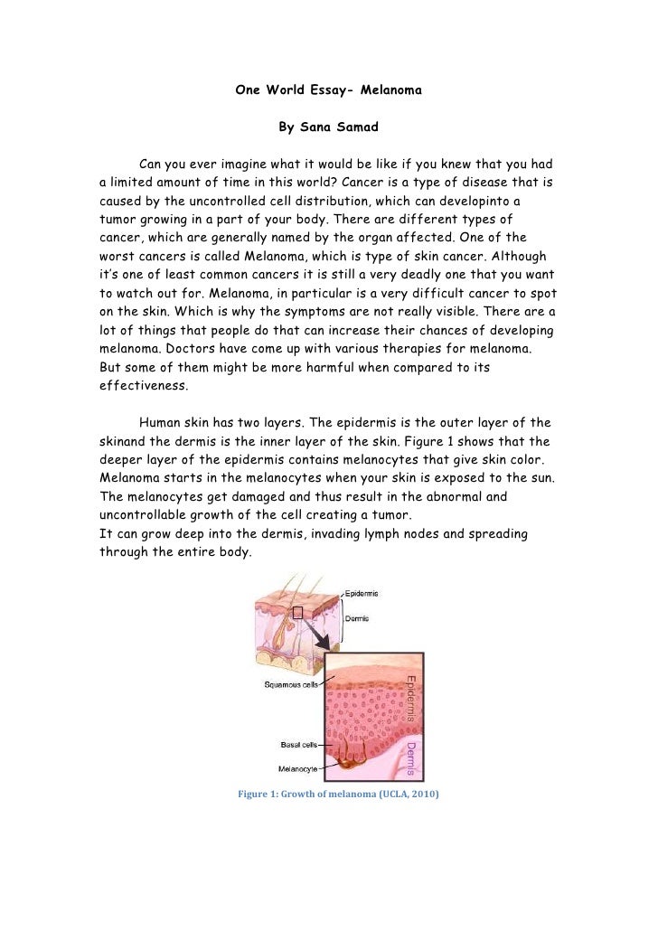 Breast Cancer Essay | Bartleby