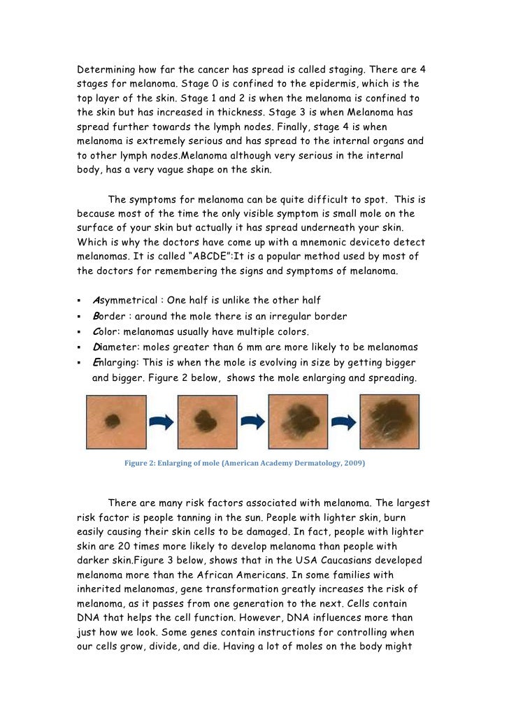 Essay on Cancer: 8 Selected Essays on Cancer