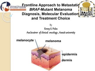 melanocyte melanoma
epidermis
dermis
Frontline Approach to Metastatic
BRAF-Mutant Melanoma
Diagnosis, Molecular Evaluation,
and Treatment Choice
By
Ereny S. Poles
Ass.lecutrer of clinical oncology, Assuit university
 