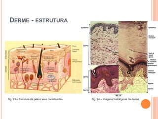 Sinais clínicos de malignidade: Bordos irregulares; Variação de padrão de pigmentação e cor; Variação de tamanho; Variação forma Sangramento; ulceração e dor.Características ClínicasLentigo maligno-melanomaMelanoma de disseminação superficialMelanoma nodularMelanoma lentiginoso acral