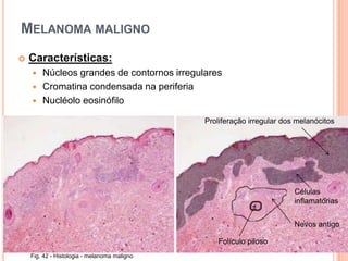 Histologia da PeleSistema TegumentarPeleAnexos cutâneosFunções da PeleProtecçãoBarreira hídricaRegulação temperatura corporalDefesa não-específicaExcreção saisSíntese vitamina DÓrgão sensorial