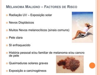 Melanoma Maligno – Factores de RiscoRadiação UV – Exposição solarNevos DisplásicosMuitos Nevos melanocíticos (sinais comuns)Pele claraSI enfraquecidoHistória pessoal e/ou familiar de melanoma e/ou cancro de peleQueimaduras solares gravesExposição a carcinogéneos