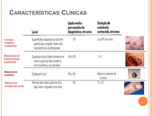 92% doentes com melanoma de famílias SNF