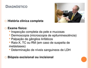 20% melanomas de famílias não-SNFMelanoma Maligno - Epidemiologia↑ progressivo do nº casos detectados4% cancros cutâneos – triplicou desde 198073% de todas as mortes por cancro cutâneoIncidência 1,2% de todos os novos casos de cancro por ano em todo o Mundo2º mais frequente nas mulheres dos 20-39 anos20% doentes morrerão < 40 anos