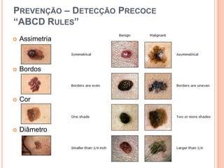 8/100 000 habitantes por ano