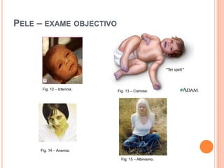 Estatísticas: Registo Oncológico Nacional (Instituto Português Oncologia de Francisco Gentil)