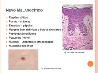  Inspecção completa da pele e mucosas