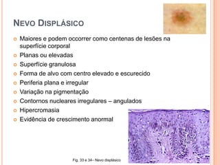  Determinação de níveis sanguineos de LDH