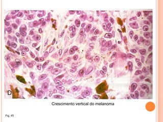 Epiderme - estruturaQueratinócitosCélulas de LangerhansCélulas de MerkelMelanócitosFig. 18 – Estratos da epiderme.Fig. 19 – Pele branca.Fig. 20 – Pele escura.