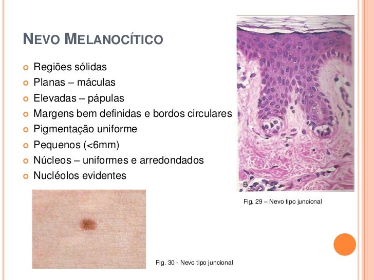 Máscara de descoramento de pele
