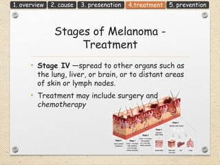 Melanoma sign symptom management surgery prevention ملانوم | PPTX