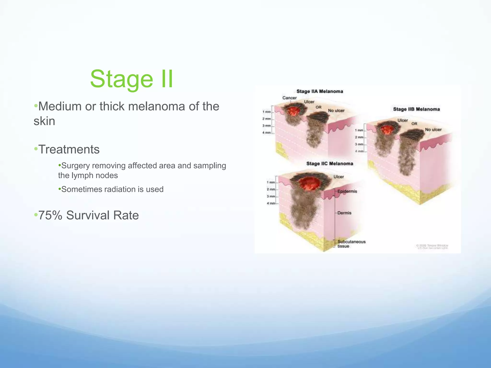 Melanoma presentation | PPTX