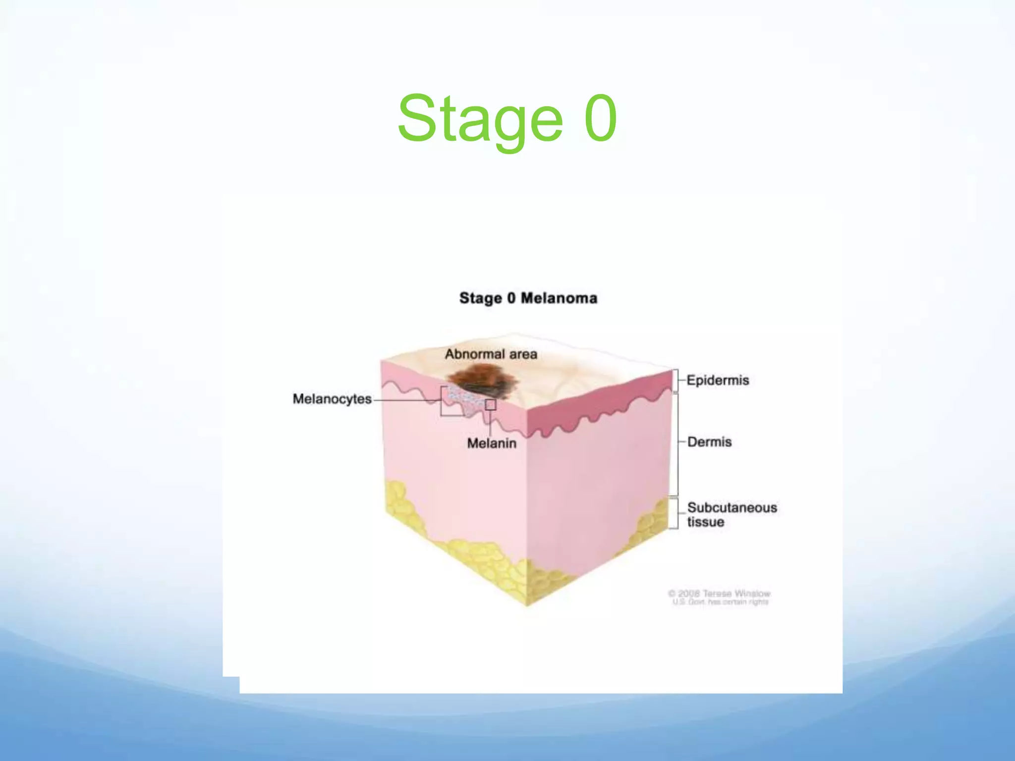 Melanoma presentation | PPTX