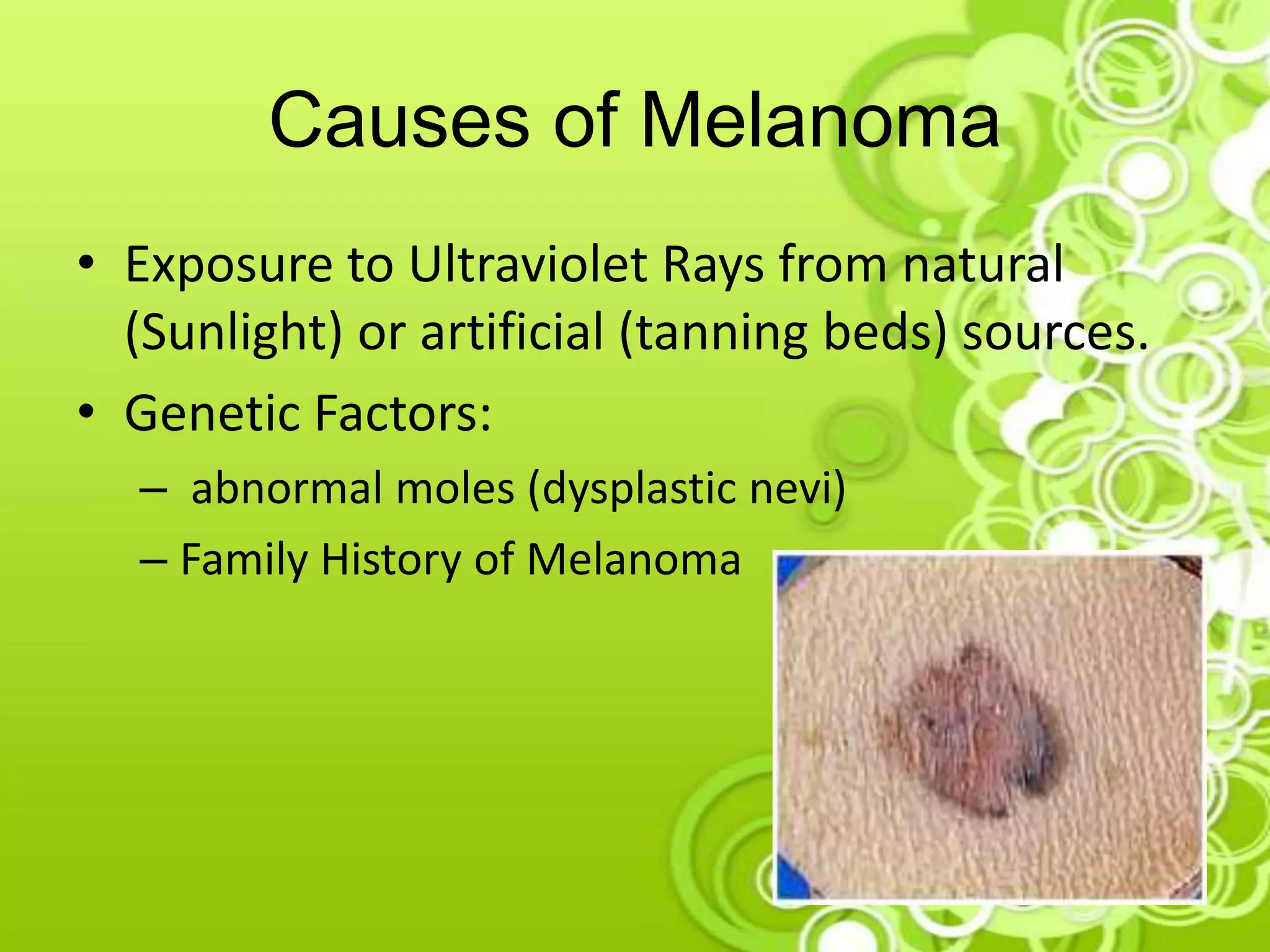 Causes of Melanoma
• Exposure to Ultraviolet Rays from natural
(Sunlight) or artificial (tanning beds) sources.
• Genetic Factors:
– abnormal moles (dysplastic nevi)
– Family History of Melanoma
 