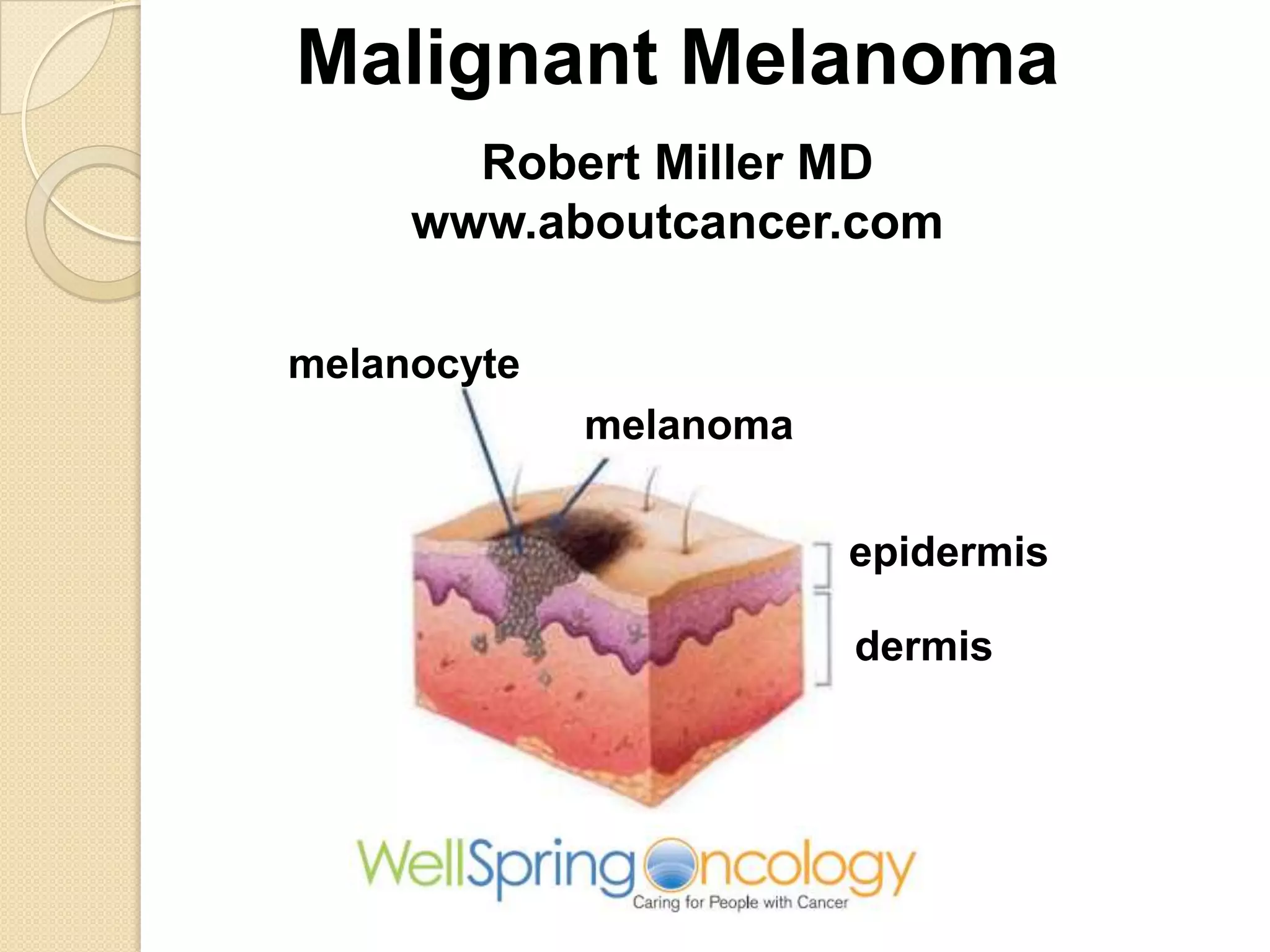 Melanoma video slides | PPTX