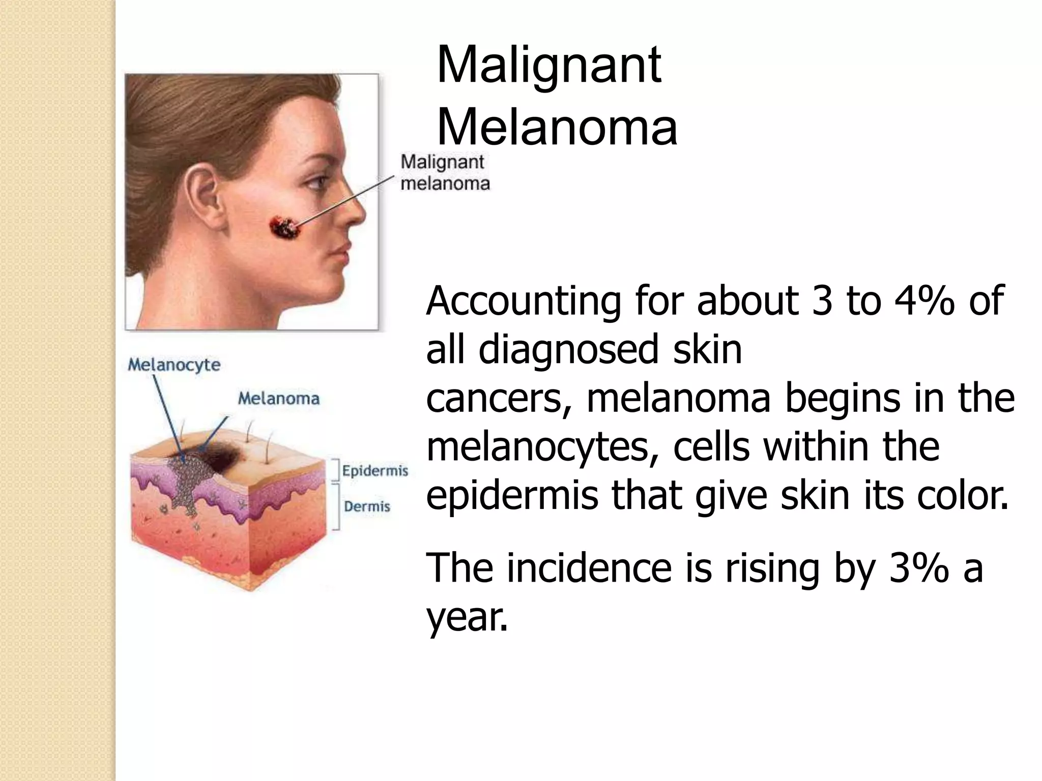 Melanoma video slides | PPTX