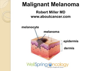 Malignant Melanoma
Robert Miller MD
www.aboutcancer.com
melanocyte
melanoma

epidermis
dermis

 