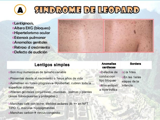 Las máscaras para la persona que blanquea