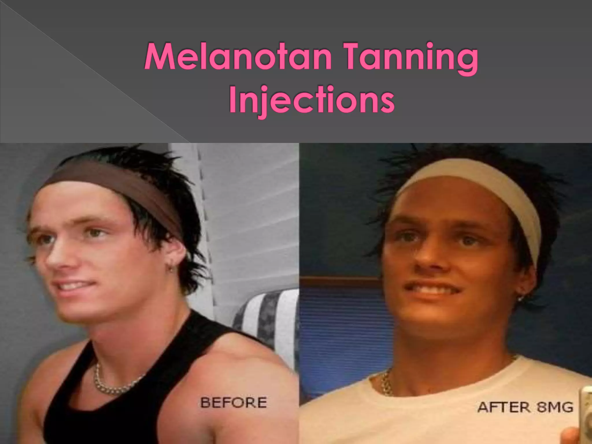 tanning injections melanotan Melanotan tanning injections