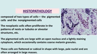Melanotic Neuroectodermal tumor of infancy