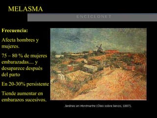 MELASMAFrecuencia:Afecta hombres y mujeres.75 – 80 % de mujeres embarazadas.... y desaparece después del partoEn 20-30% persistenteTiende aumentar en embarazos sucesivos.