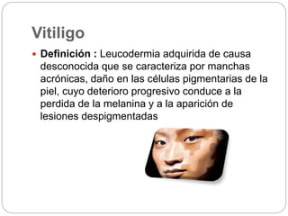 Vitiligo
 Definición : Leucodermia adquirida de causa
desconocida que se caracteriza por manchas
acrónicas, daño en las células pigmentarias de la
piel, cuyo deterioro progresivo conduce a la
perdida de la melanina y a la aparición de
lesiones despigmentadas
 