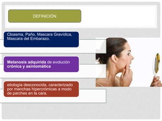 DEFINICIÓN
Cloasma, Paño, Mascara Gravídica,
Mascara del Embarazo.
Melanosis adquirida de evolución
crónica y asintomática
etiología desconocida, caracterizado
por manchas hipercrómicas a modo
de parches en la cara.
 