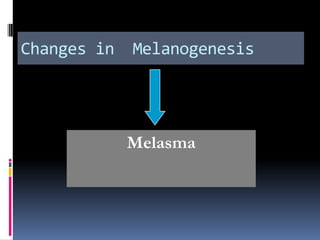 Changes in   Melanogenesis




             Melasma
 