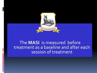 The MASI is measured before
treatment as a baseline and after each
        session of treatment
 