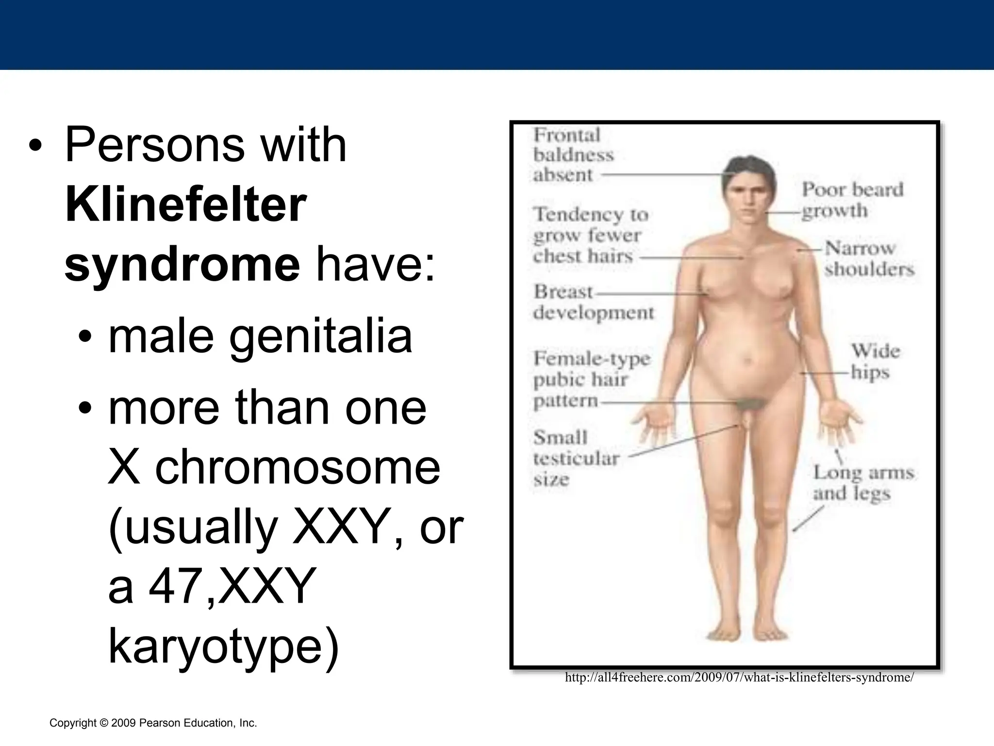 Copyright © 2009 Pearson Education, Inc.
• Persons with
Klinefelter
syndrome have:
• male genitalia
• more than one
X chromosome
(usually XXY, or
a 47,XXY
karyotype) http://all4freehere.com/2009/07/what-is-klinefelters-syndrome/
 